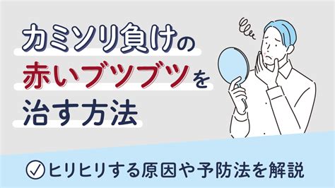 カミソリ負けの原因と防ぐためのコツとは？おすすめの処理方法。